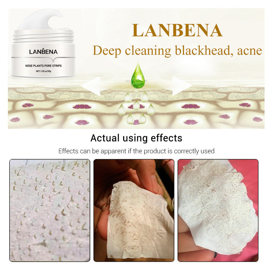 Blackhead Nasal Membrane Sucking - Luniva