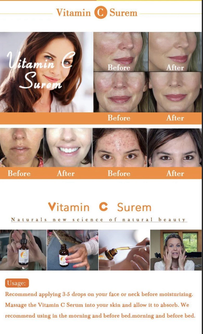 Vitamin C Serum - Luniva